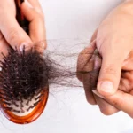 চুল পড়া কমান